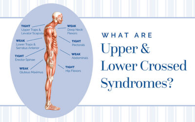 Upper crossed Syndrome vs. Lower crossed Syndrome and Treatment