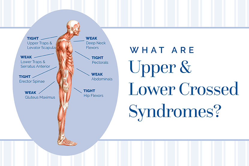 Upper crossed Syndrome vs. Lower crossed Syndrome and Treatment